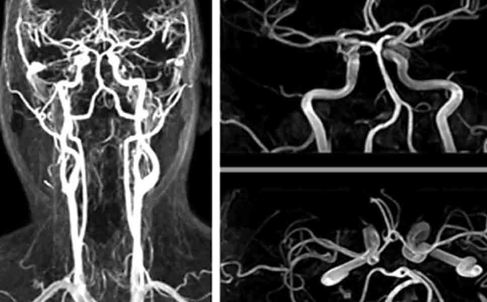 Risonanza magnetica cranio