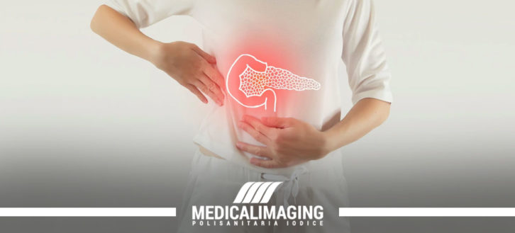 Tumore al Pancreas: sintomi e come diagnosticarlo