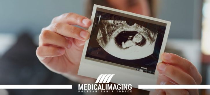 Prima ecografia gravidanza | Quando farla e cosa si vede