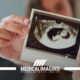 Prima ecografia gravidanza | Quando farla e cosa si vede
