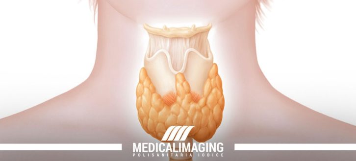 Ipotiroidismo | Cos'è, sintomi ed esami diagnostici