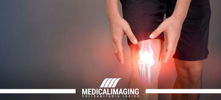 Dolore al ginocchio: le cause più frequenti, i sintomi e le possibili cure