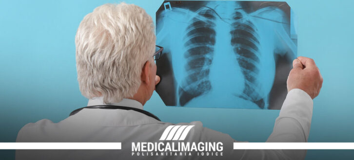 Enfisema polmonare: cause, rischi e cure